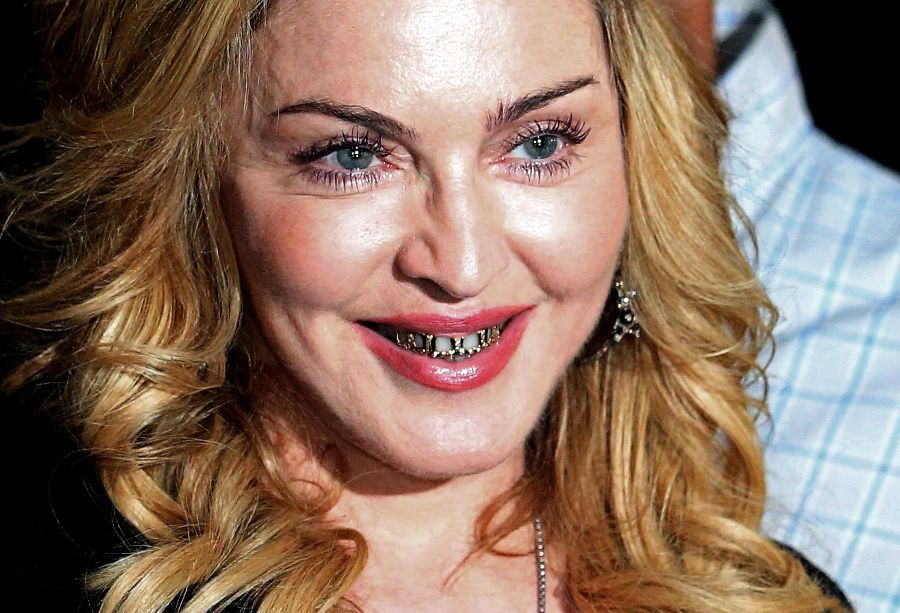 Madonna-et-son-sourire-en-or